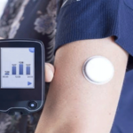Monsoon Season Brings Hidden Risks for Diabetics: Health Experts Advocate Continuous Monitoring..